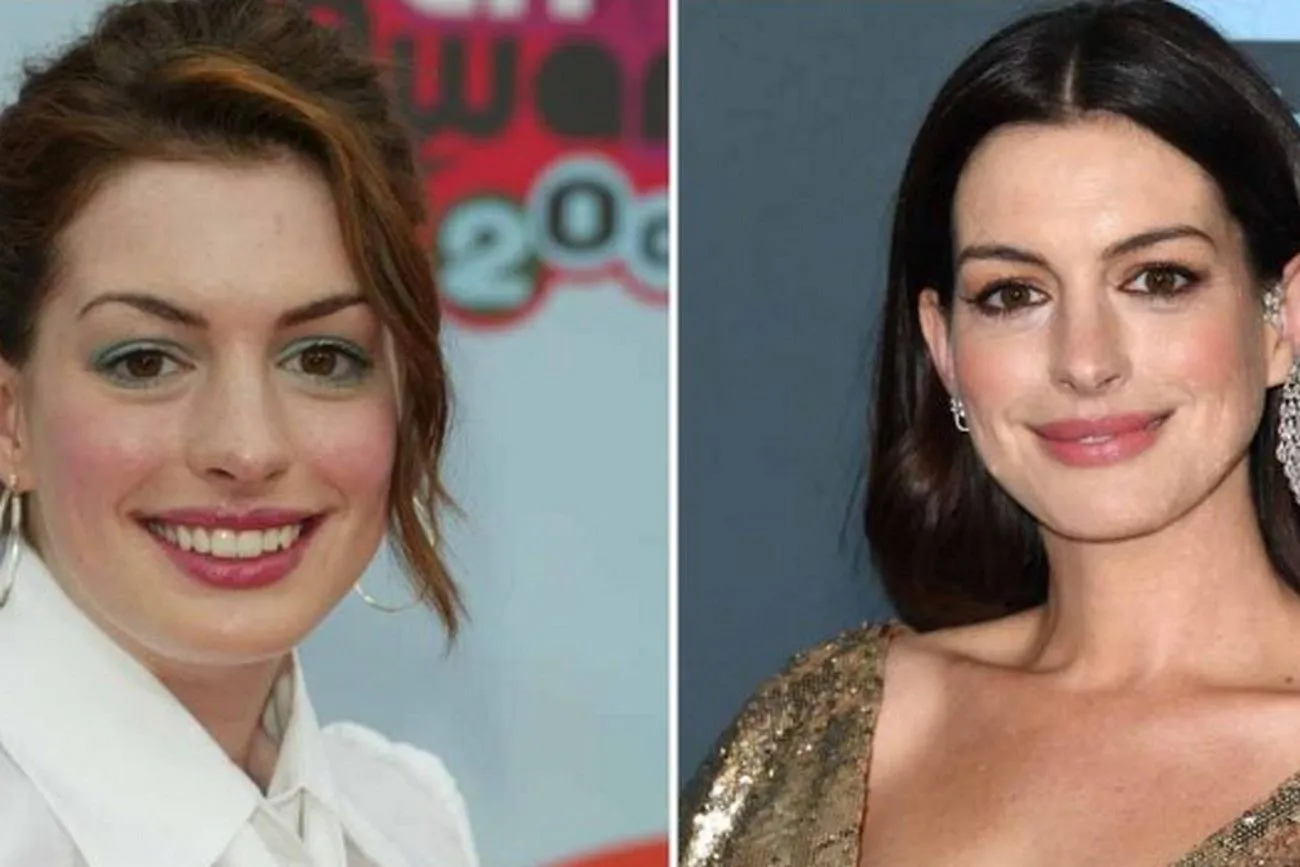 Anne Hathaway.jpg?format=webp