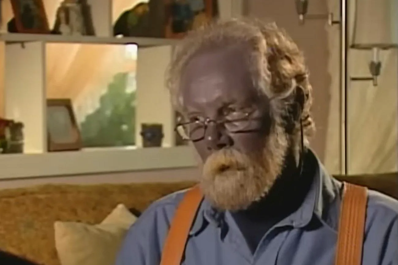 Argyria.jpg?format=webp