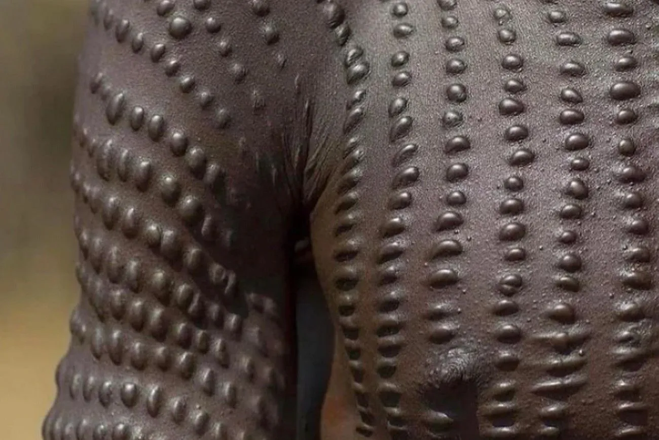 Body Scarification – West Africa.jpg?format=webp