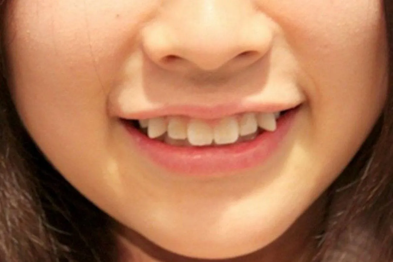 Crooked Teeth – Japan.jpg?format=webp