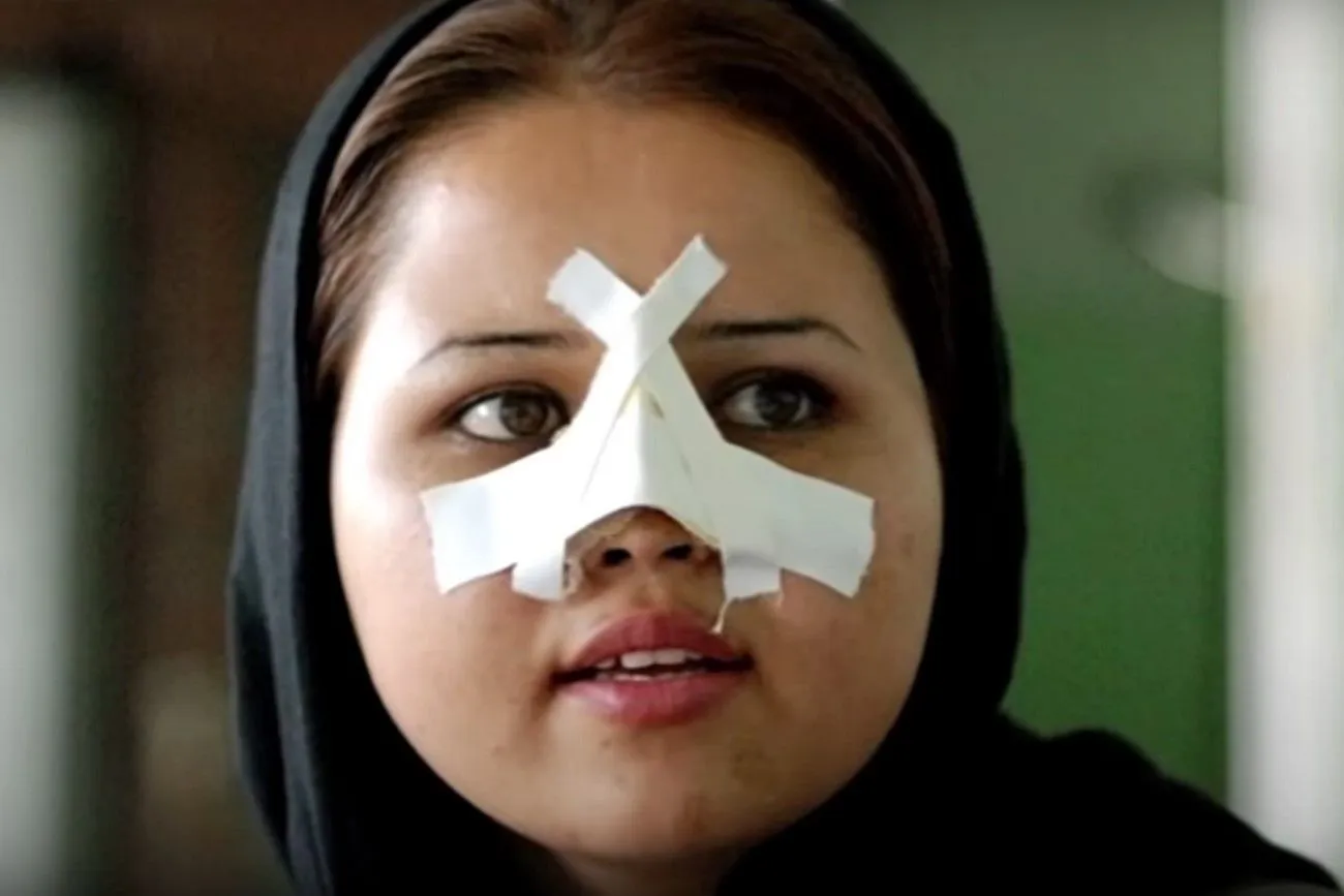 Surgical Dressing – Iran.jpg?format=webp